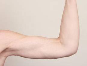 after arm lift right arm front view case 3464