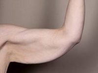 before arm lift right arm front view case 3464