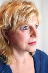after facelift | neck lift female patient right angled view case 3623