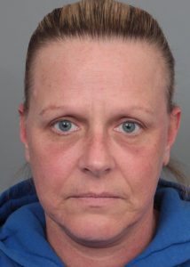 After Facelift | Neck Lift Female Patient Front Angle View Case 3514