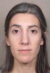 before Voluma treatment female patient front view case 3784